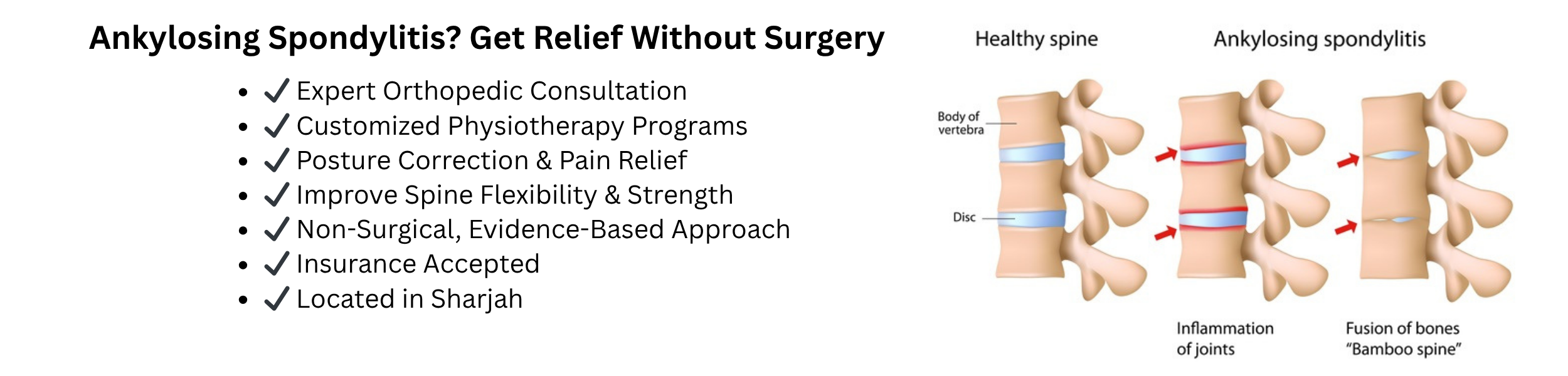 Ankylosing Spondylitis (Non-Surgical Management) Treatment in Sharjah